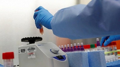 Ещё три новых случая коронавируса выявлено на Южном Урале 