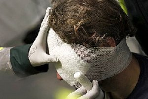 После пьянки побил  металлической скобой