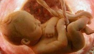 Рожать или не рожать?