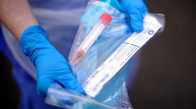 На Южном Урале число заболевших перевалило за шесть сотен 